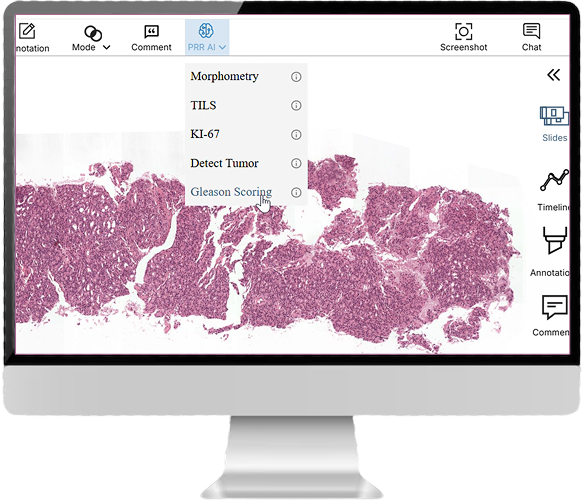 The PRR AI analysis menu open over a whole slide image, listing Morphometry, TILS, KI-67, Detect Tumor and Gleason Scoring.
