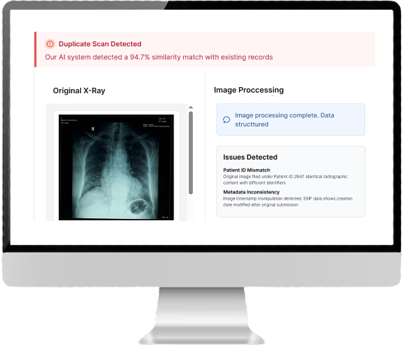A duplicate scan warning reporting a 94.7 percent similarity match with existing records, beside the original chest X-ray and a list of detected issues including a patient ID mismatch and EXIF timestamp inconsistency.