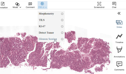 The PRR AI menu open over a slide, listing Morphometry, TILS, KI-67, Detect Tumor and Gleason Scoring analyses.